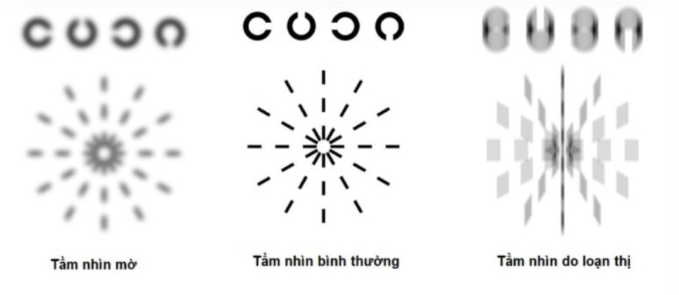 Bieu-hien-tam-nhin-cua-tre-mac-loan-thi