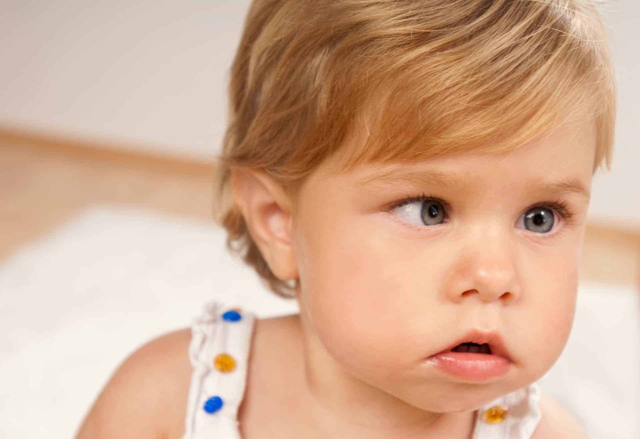 Trẻ em bị lác mắt bẩm sinh