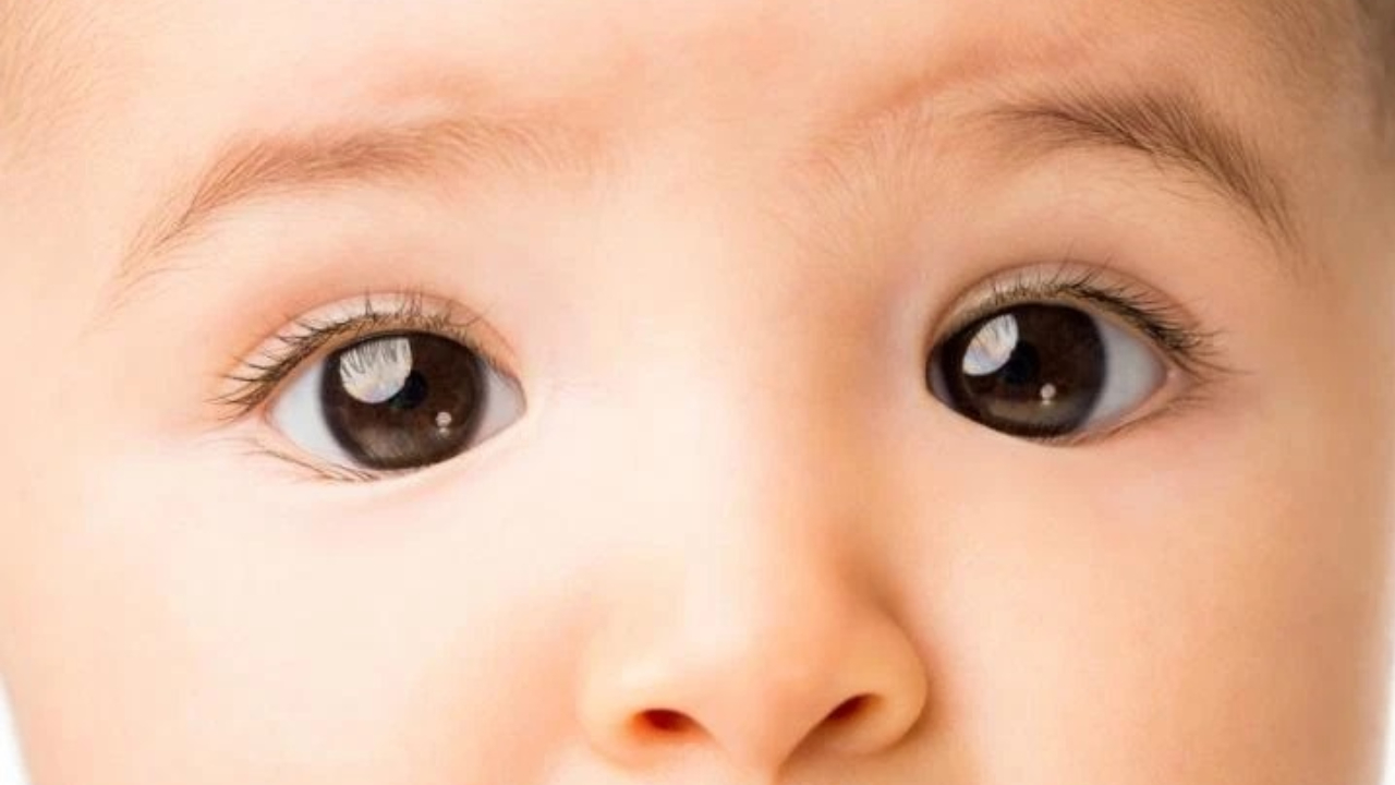 Lác mắt bẩm sinh có chữa được không? 