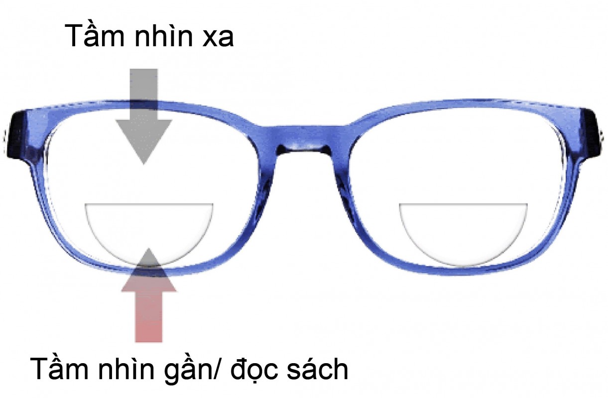 Kính gọng hai tròng cũng là một trong số tròng kính kiểm soát cận thị tốt nhất