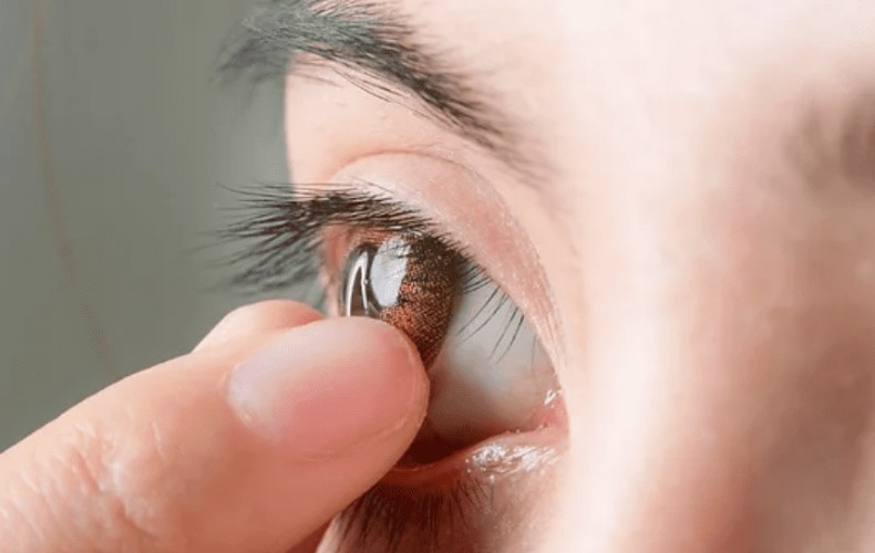 Cách xử lý kính áp tròng mềm bị kẹt trong mắt