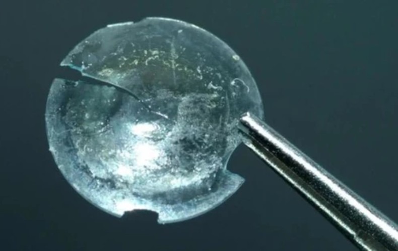 Tháo mảnh kính áp tròng bị vỡ