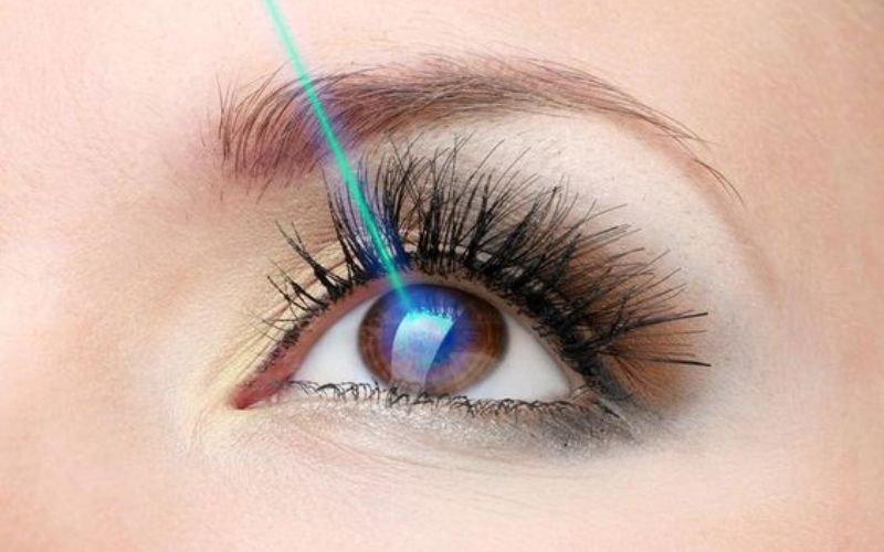 Nhiều dạng phẫu thuật cho mắt loạn thị