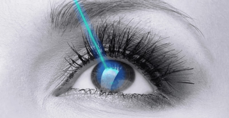 Phẫu thuật laser
