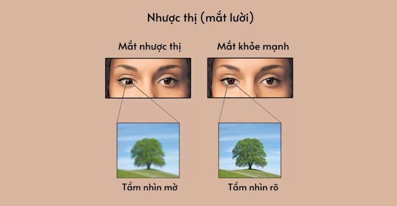 Nhược thị