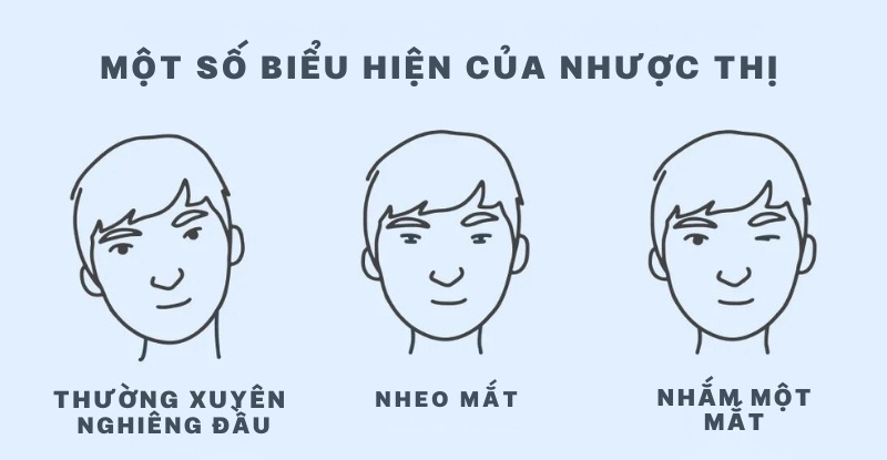 Một số biểu hiện của nhược thị