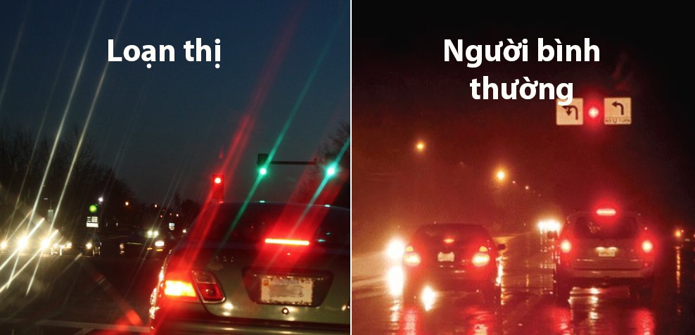 Mắt loạn thị ảnh thưởng đến thị lực