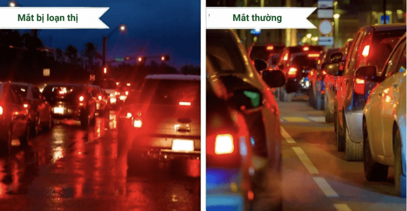 Loạn thị nên uống thuốc gì